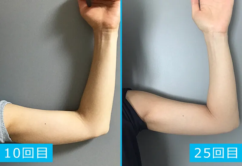 年齢に負けない！ピラティスで腕を引き締める